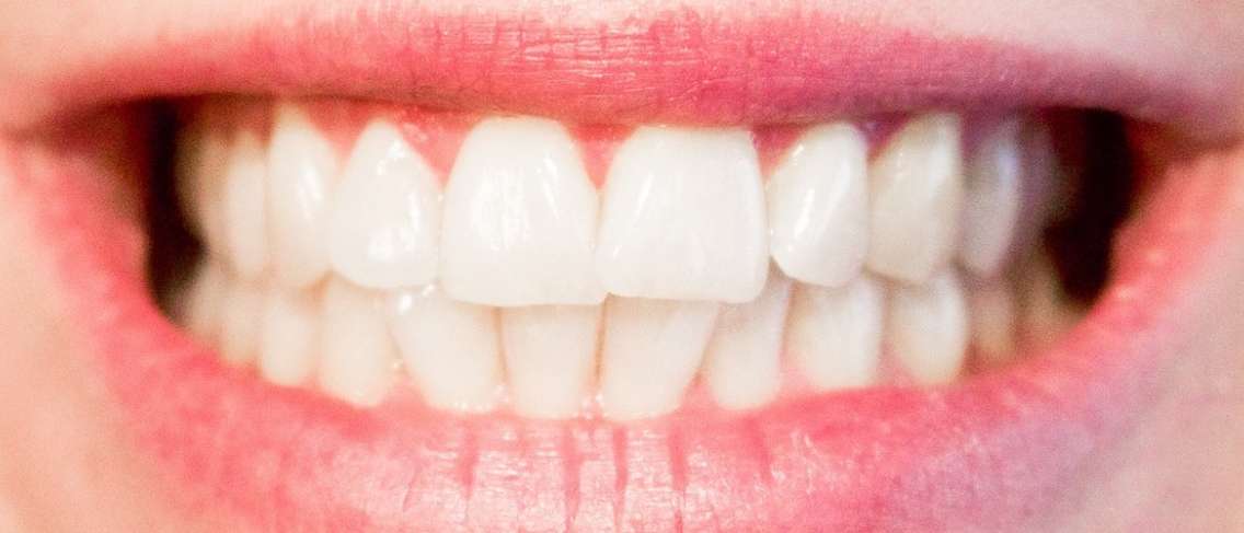 Sangat Mengganggu, Inilah 8 Cara Mengatasi Sakit Gigi Pada Waktu Malam!
