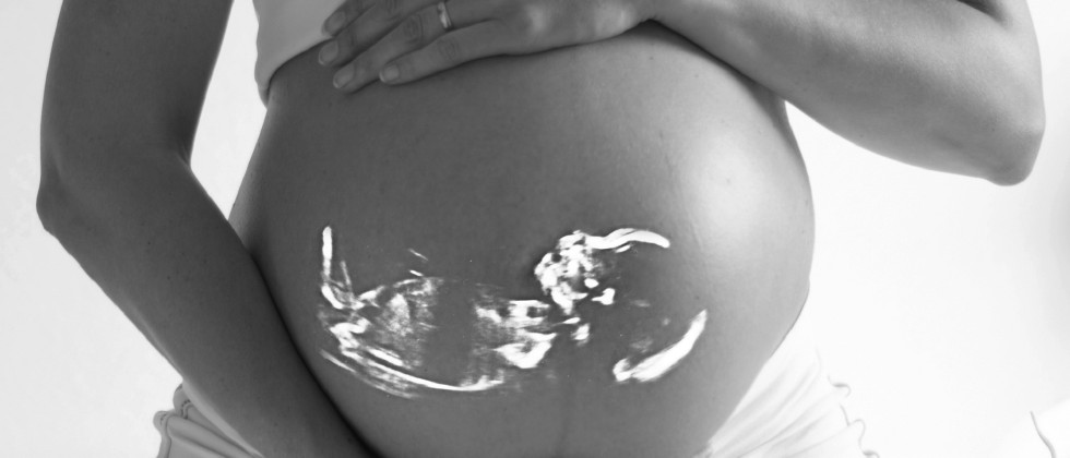 Bilakah Anda Perlu Mengalami Ultrasound Kehamilan?